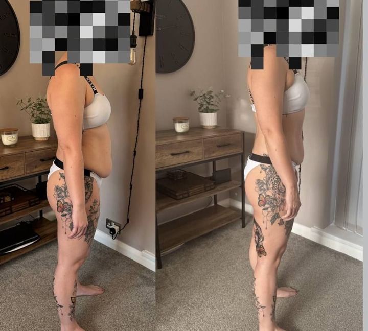 JDD client before and after photos